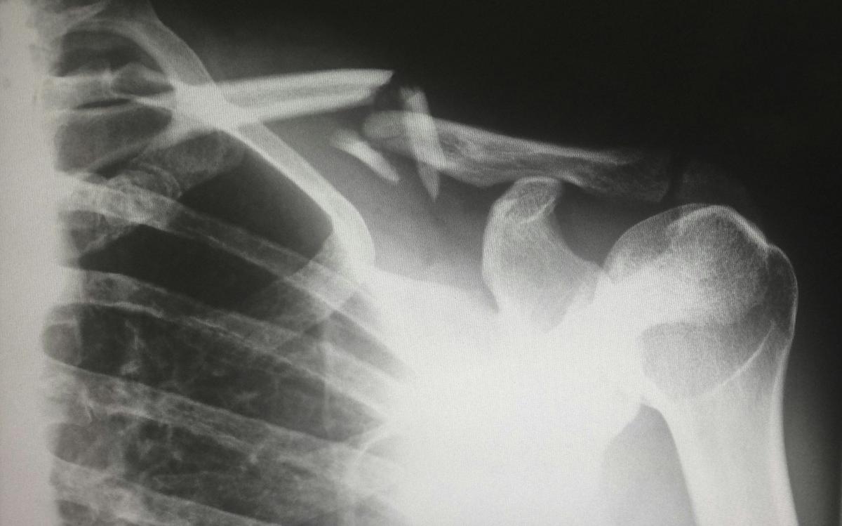 Why Summer Sends More Kids To The ER Every Year