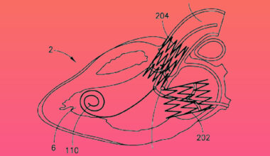 Heart diagram