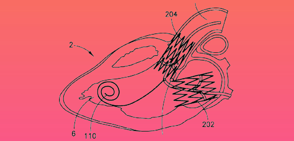 Heart diagram