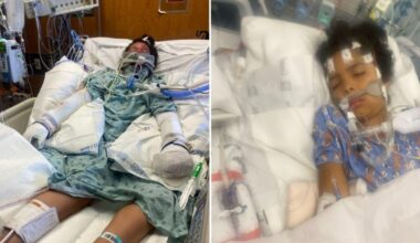 Two siblings remain in burn unit after Fort Worth fire that killed 5-year-old brother