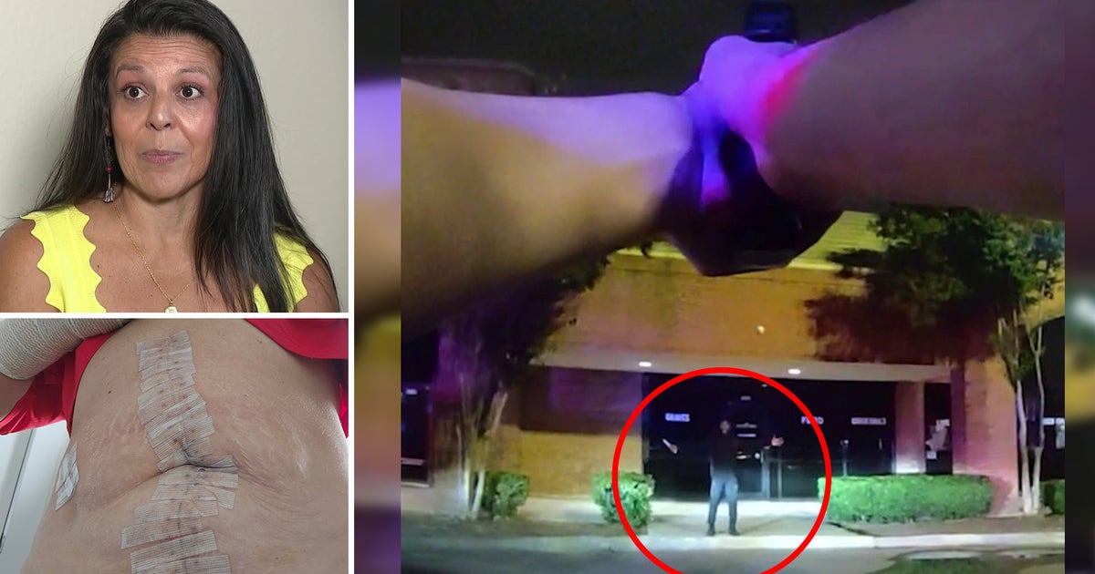 Richardson bartender still recovering after May stabbing attack