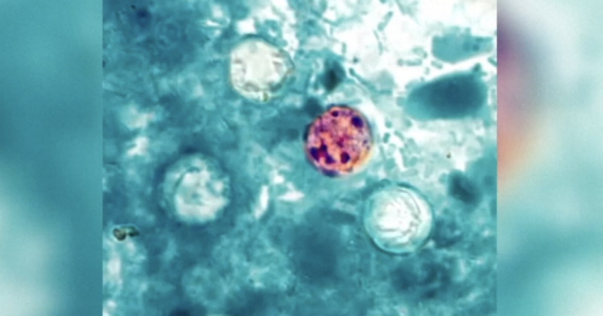 Cyclospora cases spike in Corpus Christi this summer