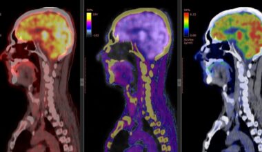 6 ways to improve your memory according to UTD brain research