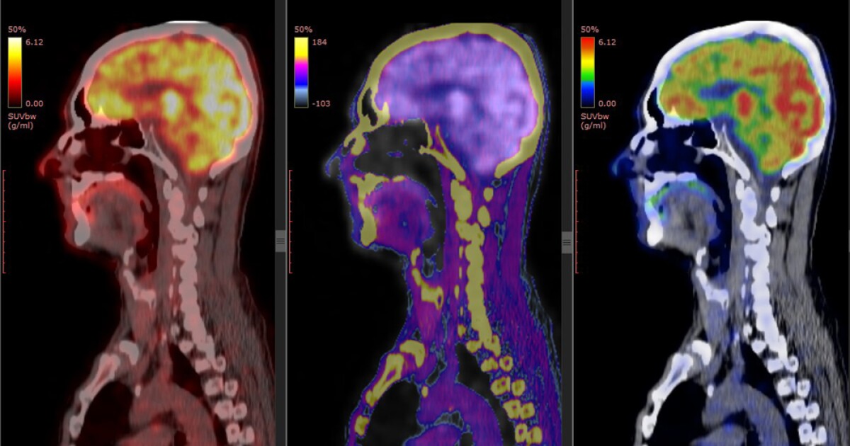 6 ways to improve your memory according to UTD brain research