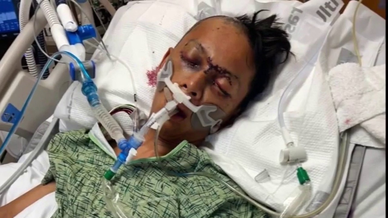 Houston family demands answers after unprovoked attack leaves man on life support
