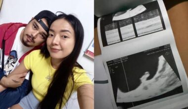 Rosmar Tan accepts pregnancy loss: 'May plano si God'