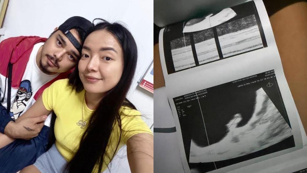 Rosmar Tan accepts pregnancy loss: 'May plano si God'