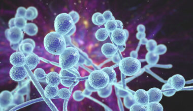 Drug-resistant ‘superbug’ on the rise in Texas