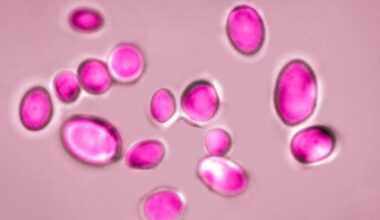 Texas leads US in cases of dangerous fungal infection