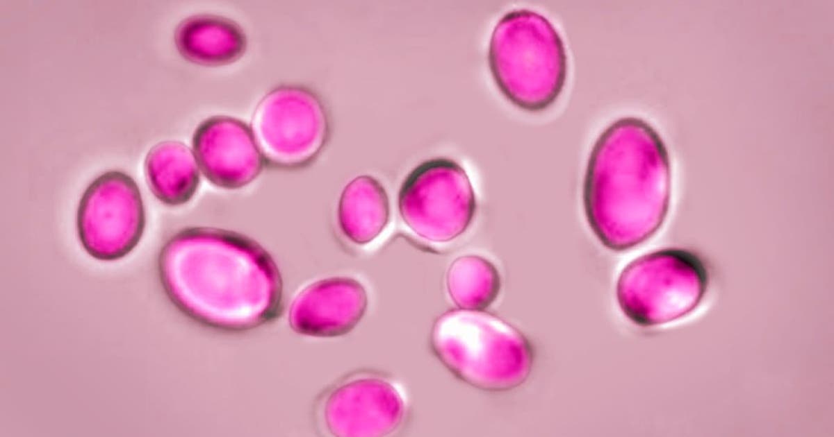 Texas leads US in cases of dangerous fungal infection