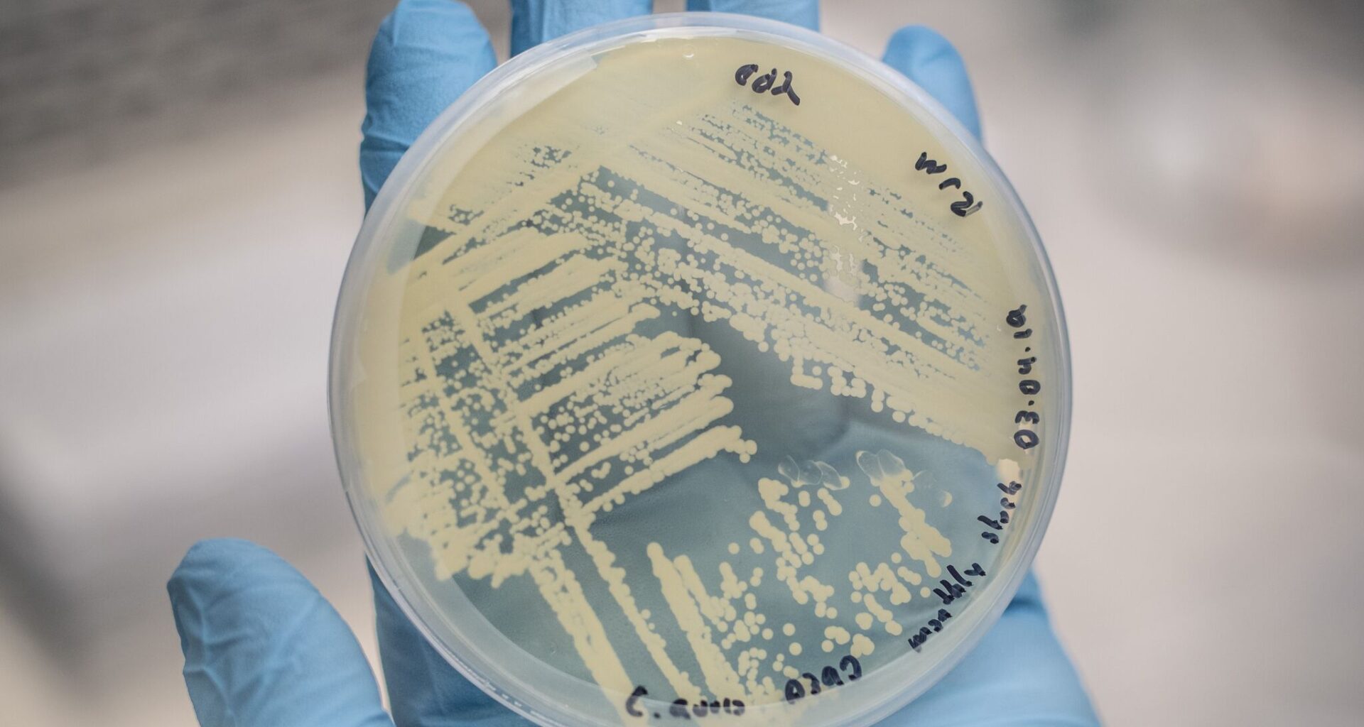 Texas becomes hotspot for life-threatening fungal infections