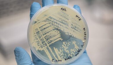Texas becomes hotspot for life-threatening fungal infections