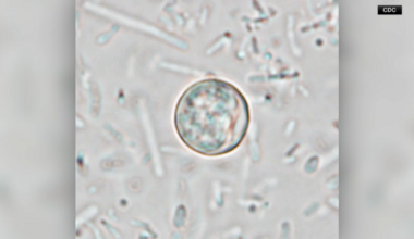 Cyclosporiasis cases at 54 in Harris County; 10 new cases reported in Houston, health officials say