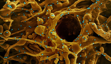 A scanning electron microscope image showing a large infected cell with numerous virus particles emerging from its surface. The cell displays extensive branching, filament-like projections extending outward. Multiple round virus particles are scattered across the cell surface and surrounding area, illustrating active viral budding and release.
