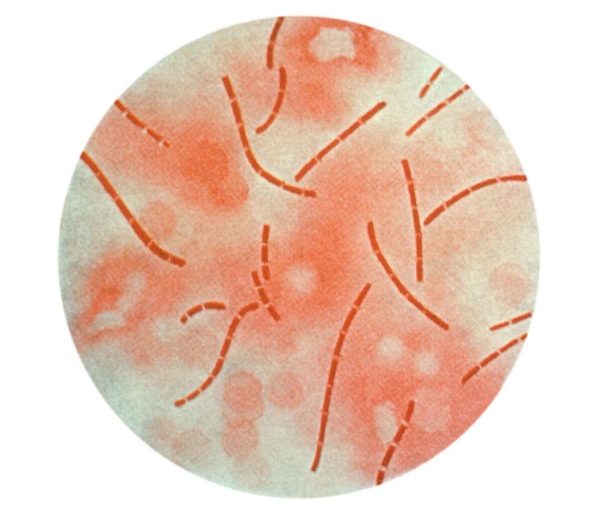 Goat tests positive for deadly anthrax west of San Antonio