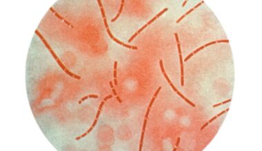 Goat tests positive for deadly anthrax west of San Antonio