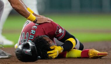 Arizona’s Perdomo leaves game with head contusion after being hit in the helmet by a line drive