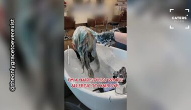 Texas Woman Discovers She's Allergic to Her Own Job