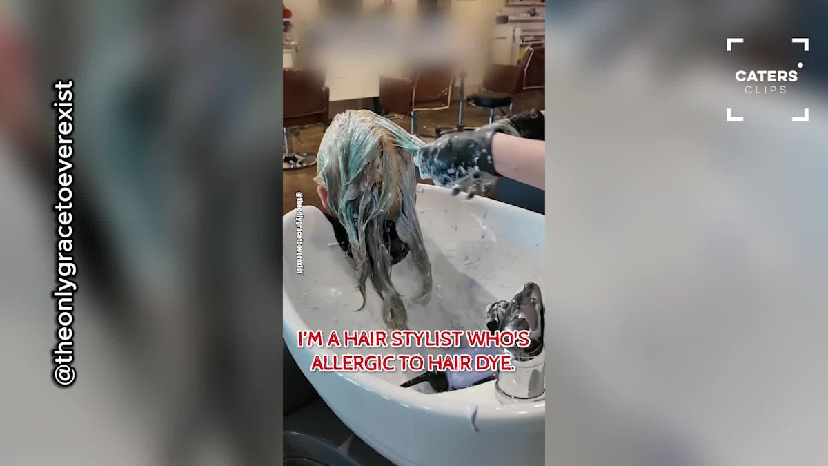 Texas Woman Discovers She's Allergic to Her Own Job