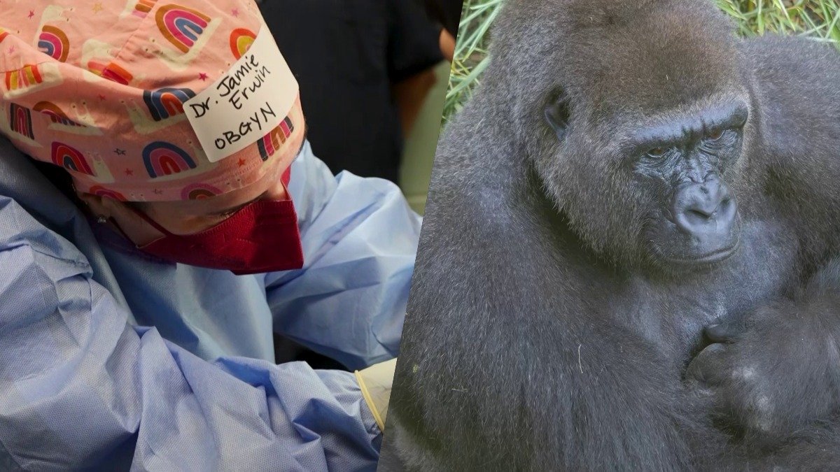 Dallas Zoo gorilla’s pregnancy leads to rare surgery by human doctors – NBC 5 Dallas-Fort Worth