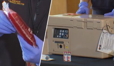 Dallas Fire-Rescue mobile blood program credited with saving 75 – NBC 5 Dallas-Fort Worth
