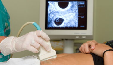 Parkland study could change how hospitals treat a leading cause of maternal, infant mortality