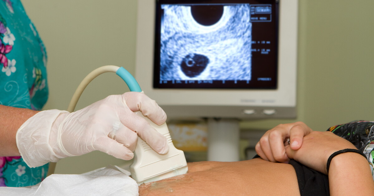 Parkland study could change how hospitals treat a leading cause of maternal, infant mortality