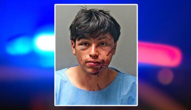 Suspect seen bloodied in mugshot after Fort Worth hit-and-run injures 2