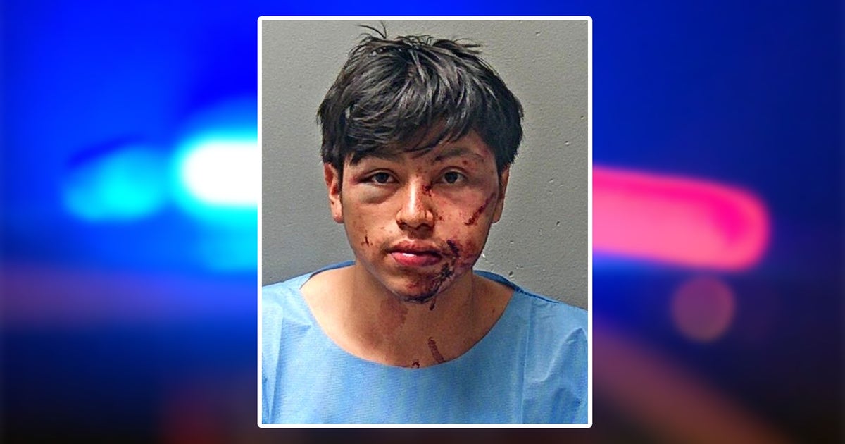 Suspect seen bloodied in mugshot after Fort Worth hit-and-run injures 2