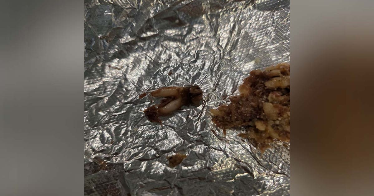 Austin woman sues Torchy's Tacos after finding 'cow tooth' in her taco
