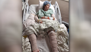 Mother of four hospitalized after dog attack in Polk County