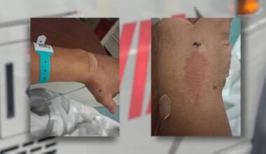 ‘I don’t feel safe’: San Antonio man recalls violent attack while riding VIA bus