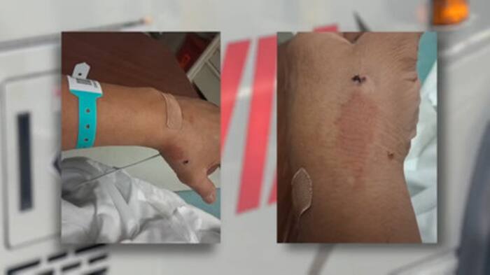 ‘I don’t feel safe’: San Antonio man recalls violent attack while riding VIA bus