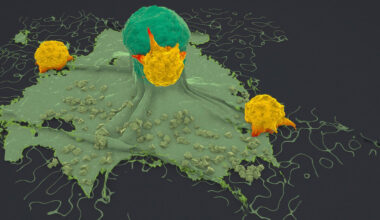 AI tool reveals what attracts immune cells to tumors and what keeps them away