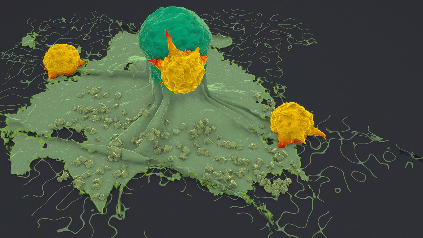 AI tool reveals what attracts immune cells to tumors and what keeps them away
