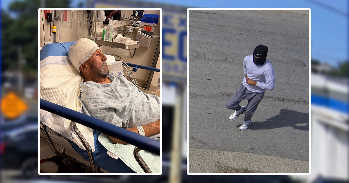 Dallas business owner pistol whipped during robbery, police search for suspect