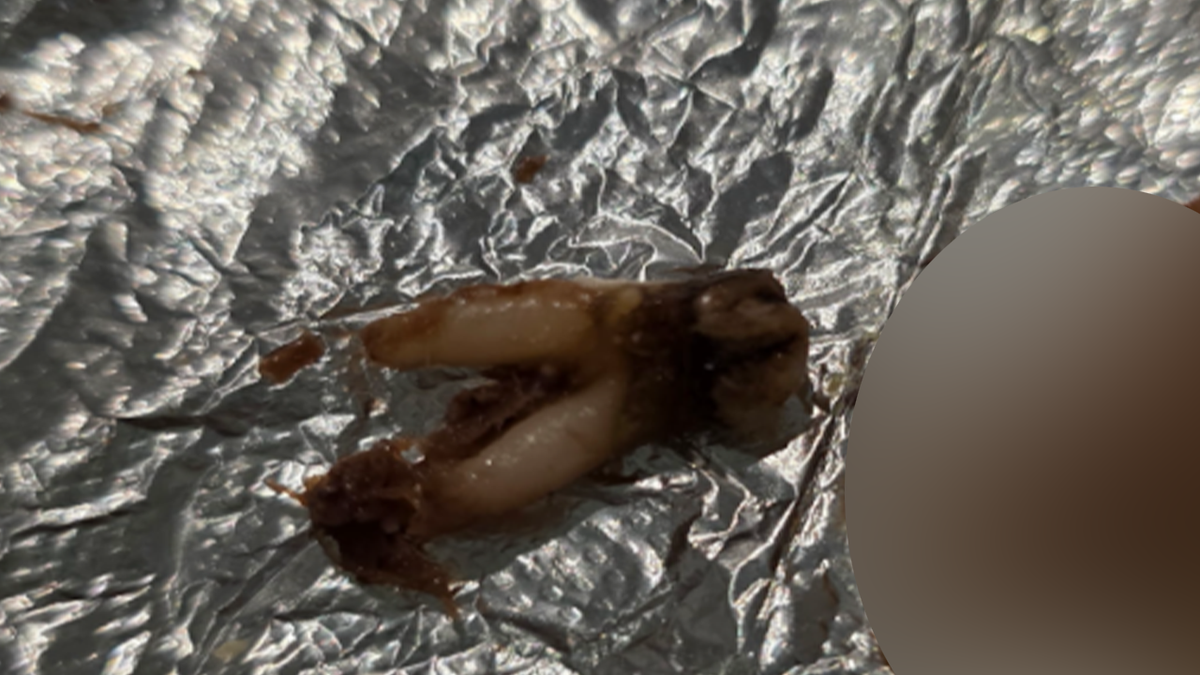 Close-up of cow tooth allegedly found in Torchy's Tacos meal