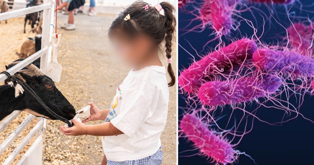 Dallas health officials investigating if E. coli cases came from State Fair of Texas petting zoo