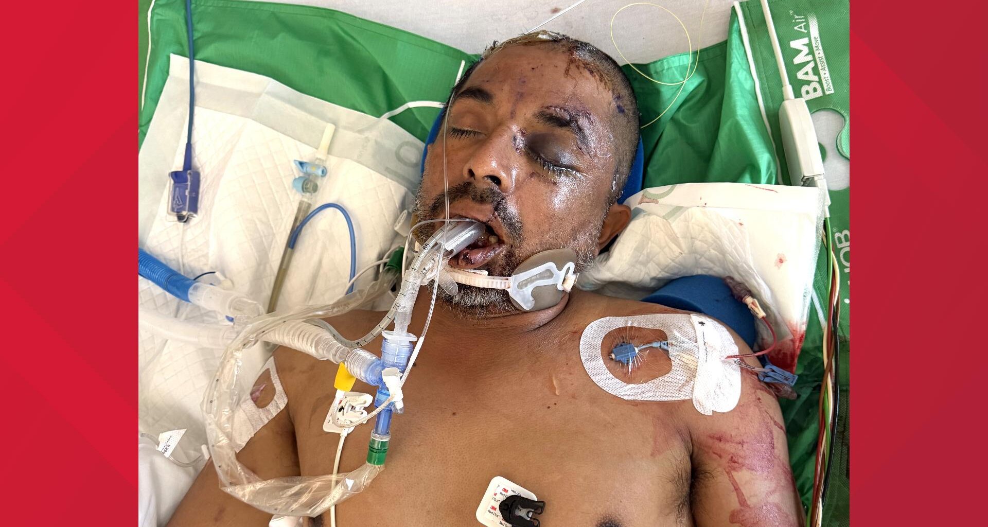 University Hospital asks for help identifying unconscious patient hit by truck Saturday evening