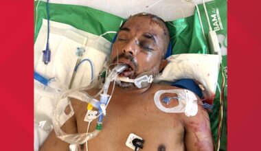University Hospital asks for help identifying unconscious patient hit by truck Saturday evening