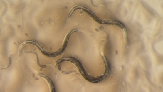 Roundworm genome map benefits synthetic biology, human health