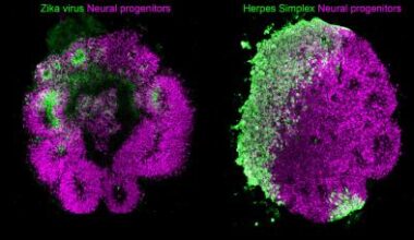Brain organoids
