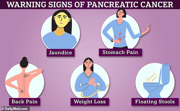 Early signs of pancreatic cancer include jaundice, stomach pain, back pain and floating stools