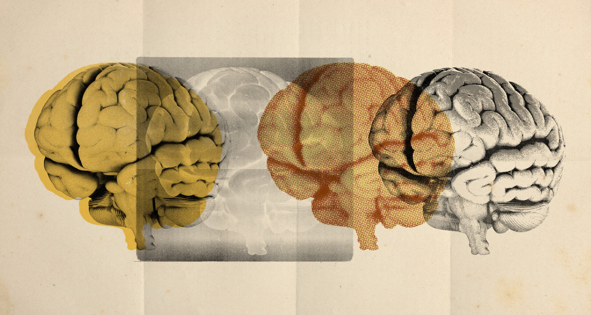 Photo collage of four images of a brain rendered in different styles