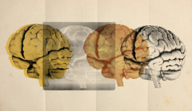 Photo collage of four images of a brain rendered in different styles