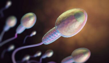 Lots Of Sperm Going To The Egg