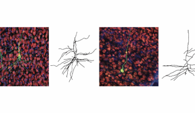 Altered transcription in dup15q syndrome; and more