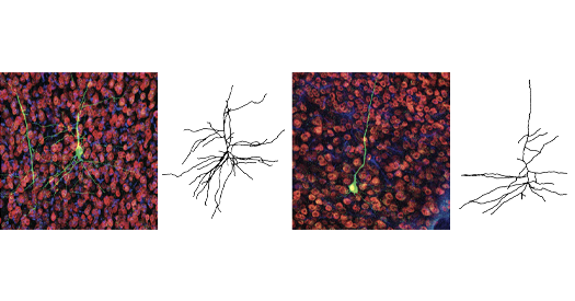 Altered transcription in dup15q syndrome; and more
