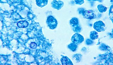 Child dies after contracting brain-eating amoeba, hospital says – WSB-TV Channel 2