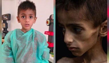 Image of Gazan child with genetic illness being used to falsely smear Israel, COGAT charges